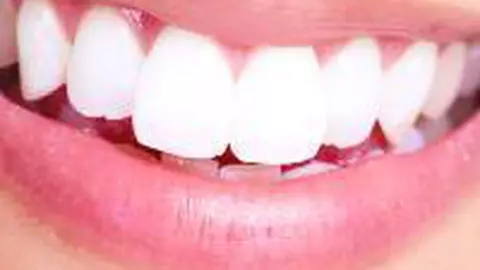 Dr. Octavian Făgăraş îţi răspunde la întrebări! Astăzi vorbim despre albirea dentară!