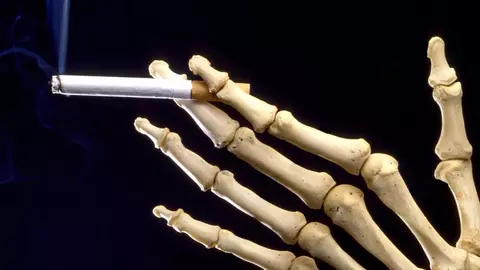 La fiecare 30 de secunde cineva moare de cancer pulmonar