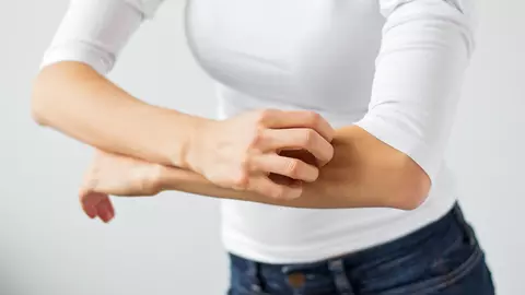 Ce să NU faci dacă ai mâncărimi