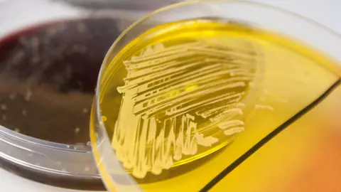 Cum îţi dai seama că ai fost infectată cu stafilococ auriu