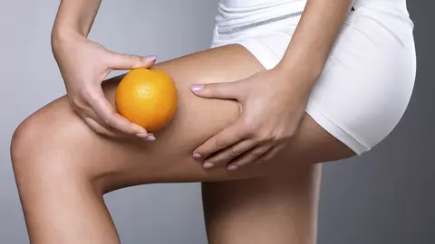 Crema care te scapă de celulită în 7 zile