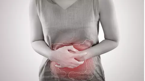 Cancer de colon, afecțiunea care are simptome înșelătoare. Cum îl depistezi la timp?