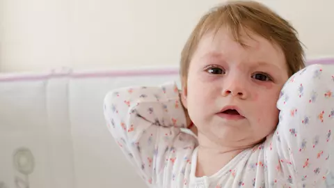 Epidemia de rujeolă a făcut încă 33 de victime în ultima săptămână
