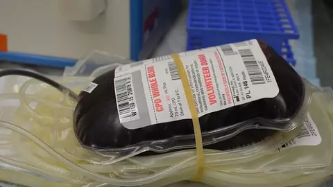 Anemia este ereditară. Cum o depistezi