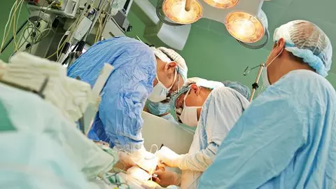 Fumatul crește riscul de anevrism cerebral