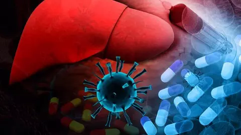 Ciroza hepatică este o boală înșelătoare. Ce trebuie să faci ca să nu ajungi prea târziu la medic