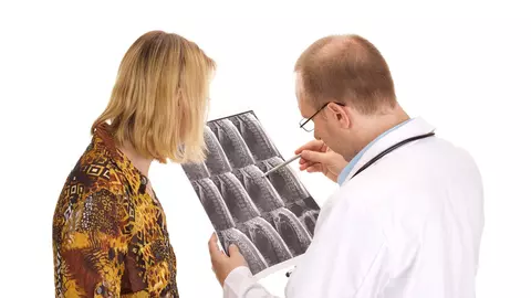 Scleroza multiplă poate fi controlată. Uite care este tratamentul revoluționar
