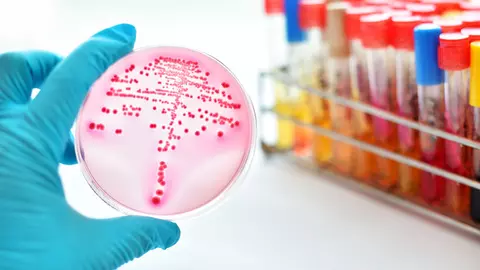 Testul care ajută la prevenirea cancerului, disponibil și în România
