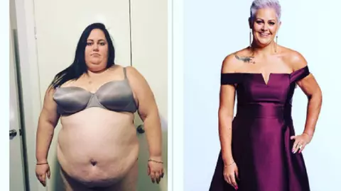 După ce i s-a spus că poate muri în orice clipă, o femeie și-a schimbat radical stilul de viață. Cum a reușit să slăbească 115 kilograme?