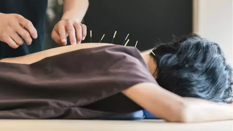Cum te ajută acupunctura să pierzi 7 kilograme în 2 luni?