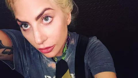 Lady Gaga, boala cronică de care suferă. Milioane de oameni sunt în situația asta