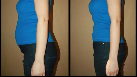 Cum se prepară cel mai bun remediu natural împotriva balonării? Îmbunătățește digestia și te ajută să slăbești