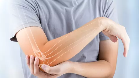 Cum să scapi de osteoporoză cu un tratament inedit! Este foarte ușor, iar rezultatele sunt incredibile