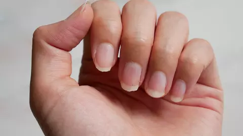 Te-ai săturat de unghiile fragile, care se rup foarte ușor? Iată tratamentul natural care le întărește și le regenerează