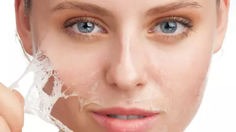 Pielea ta se usucă în timpul sezonului rece? Acestea sunt cele 3 alimente pe care trebuie să le consumi pentru a evita această problemă