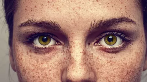 Cum să scapi de pistrui în doar câteva săptămâni! Tratamentele naturale care fac minuni pentru pielea ta