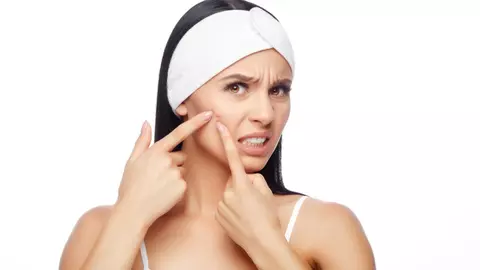 Alimentele pe care trebuie să le eviți dacă ai probleme cu acneea. Aspectul pielii se va îmbunătăți rapid