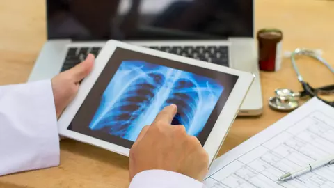 Care sunt bolile pulmonare cu incidență crescută în România