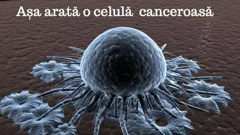 Ce este cancerul?