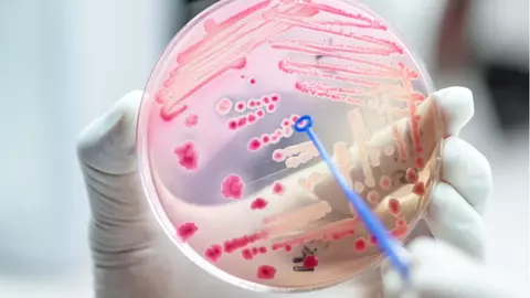 Substanța care poate crește rezistența la antibiotice. Uite în ce produse de îngrijire o poți găsi