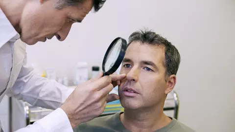 Carcinomul cutanat este cel mai frecvent cancer de piele. Este mai puțin periculos decât melanomul, dar apare mult mai des
