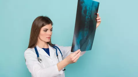 Osteosarcomul, cel mai întâlnit tip de cancer osos. Uite la ce vârstă poate să apară și care sunt primele semne
