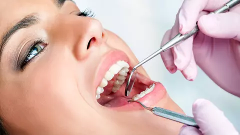 Ce sunt faţetele dentare? Care sunt avantajele şi dezavantajele folosirii acestei proceduri