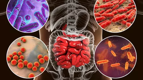 Moartea începe în colon, așa spune un laureat al Premiului Nobel pentru Medicină. Iată de ce