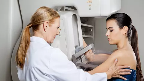 Cum arată cancerul de sân la mamograf? Iată imagini