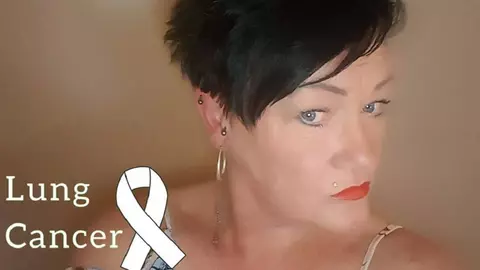 Aspectul unghiilor poate fi un indiciu al cancerului pulmonar