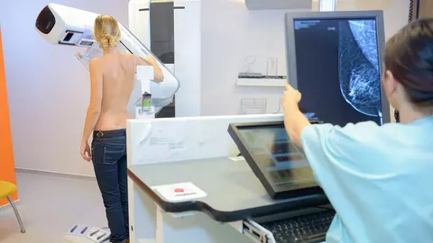 Tot ce trebuie să știm despre mamografie