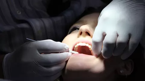 (P) Implanturi dentare în Clinica Stomatologică Dental Excellence