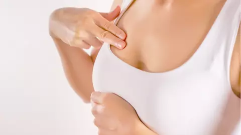 Problemele cu care se confruntă femeile cu cancer de sân în România