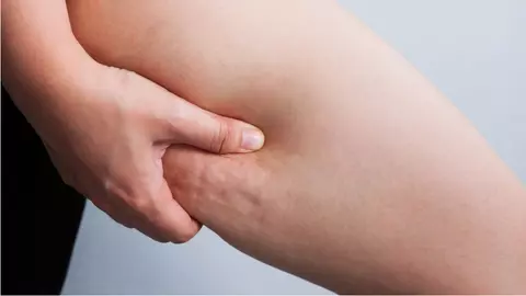 Obiceiurile care duc la apariția celulitei. Evită să faci aceste lucruri dacă vrei să scapi de aspectul de coajă de portocală