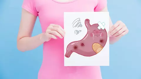 Cum să previi cancerul de stomac. 17 reguli de la un celebru neurochirurg