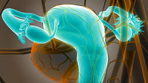 Ce presupune histerosonografia, procedura de investigare a trompelor uterine