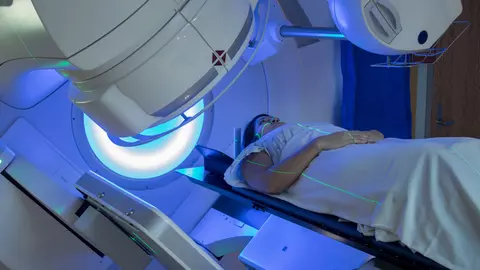 3 lucruri pe care trebuie să le știi despre radioterapie. Care sunt efectele reale ale iradierii asupra organismului