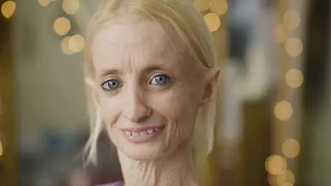 Femeia care îmbătrânește de 8 ori mai repede decât ar fi normal. Care este explicația?