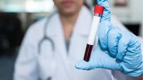 Infecţia cu virus hepatitic C, o importantă problemă de sănătate publică la nivel global - Testare gratuită pentru hepatita C