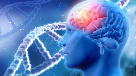 Simptomele care pot anunța cancerul cerebral. De cele mai multe ori sunt ignorate!