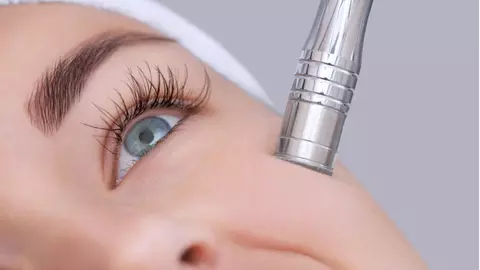 Tratamentul care te scapă de cicatricile inestetice