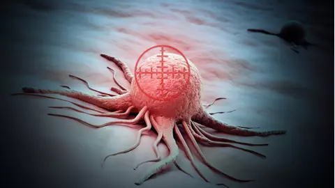 Iată ce trebuie să știi despre cancer: informații vitale cu ajutorul cărora nu vei mai face confuzii
