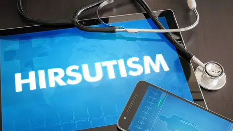 Hirsutismul sau hipertricoza. Ce este și ce soluții există pentru această afecțiune