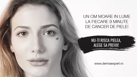 (P) Clinica Derma Expert by Elōs lanseaza campania  “Nu-ti risca pielea, alege sa previi!”