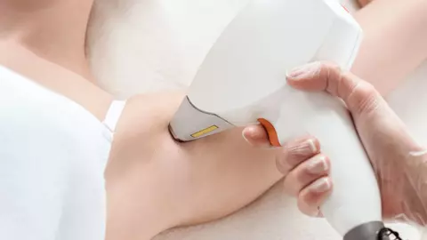 (P) De ce merită să investești în epilarea definitivă cu laser?