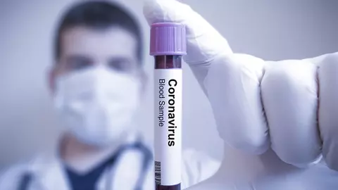 Cum beneficiază Planeta de pe urma pandemiei de coronavirus?