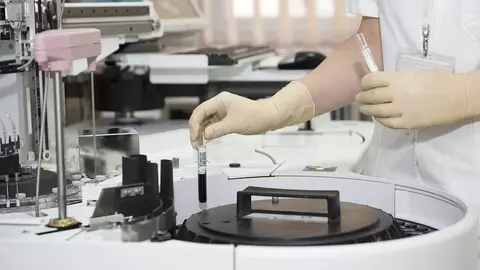 Teste coronavirus: câte tipuri sunt și care dă cel mai precis rezultat
