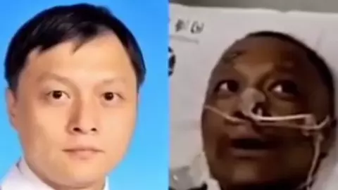 Doi medici chinezi infectați cu Covid au devenit... negri în urma tratamentului