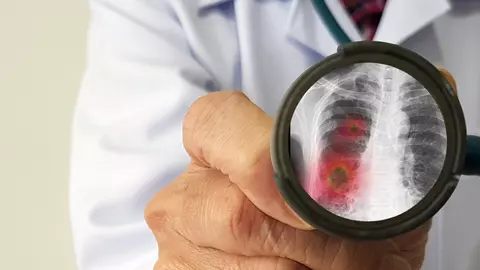 Au început să moară tot mai mulți copii de coronavirus: ultima victimă, un băiat de 13 ani