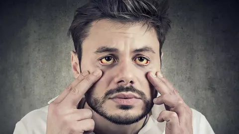 Gata cu sprițul pân' la ziuă!! Uite ce băuturi îți curăță ficatul